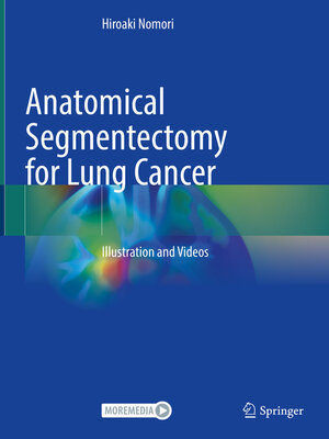 cover image of Anatomical Segmentectomy for Lung Cancer